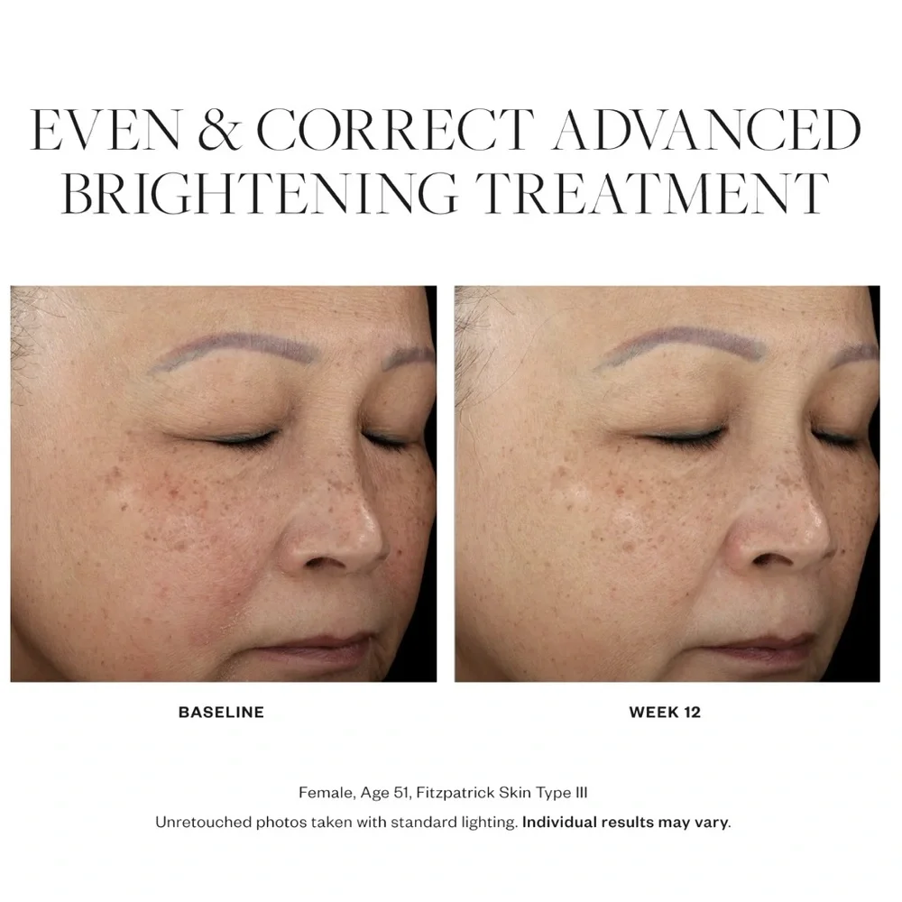 SkinMedica Unopened Even And Correct Advanced Brightening Treatment, 2 Ounce